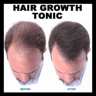 grow hair loss regrowth tonic shampoo 60day treatment read why