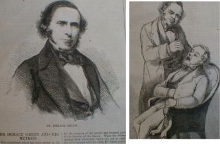 Medicine Throat Surgery 1859 Prince Alfred Malta Visit